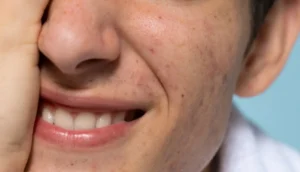 Dark Spots on Gums: Causes, Treatment, and Prevention